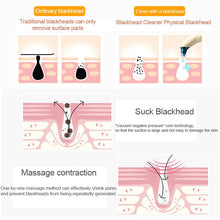 Cargar imagen en el visor de la galería, Limpiador facial de poros, aspirador de poros, removedor de espinillas, succión, exfoliación de acné